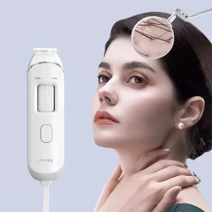 scalp camera, hair camera,